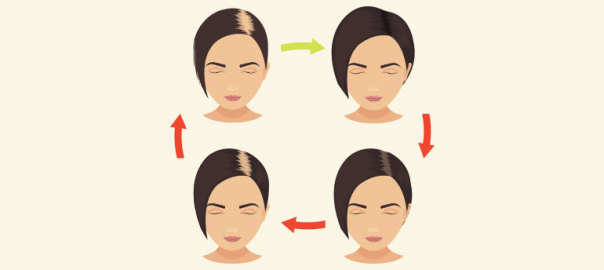 hair loss in women treatment