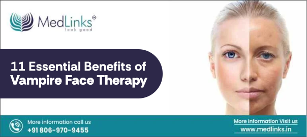 MedLinks Aesthetic Vampire Face Therapy