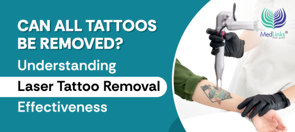 Advanced Laser Tattoo Removal, MedLinks Aesthetics