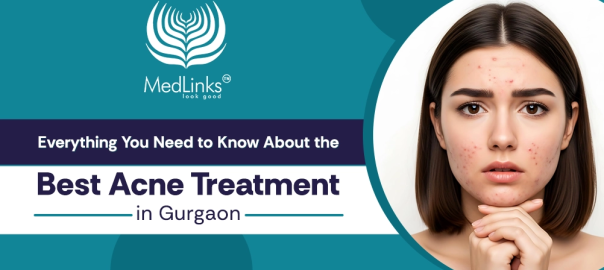 Best Acne Treatment in Gurgaon, MedLinks Aesthetics