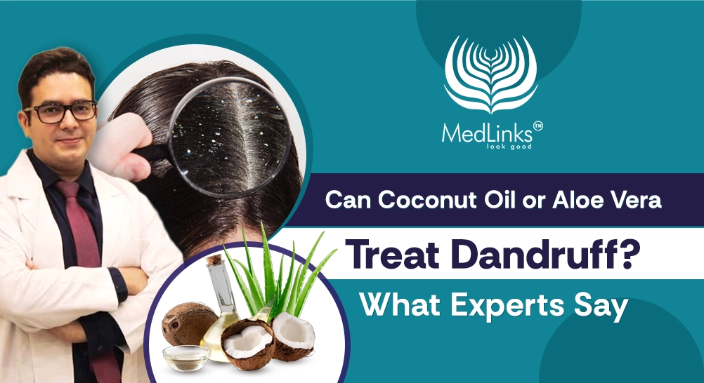 Can Coconut Oil or Aloe Vera Treat Dandruff? What Experts Say. - Medlinks  Look Good