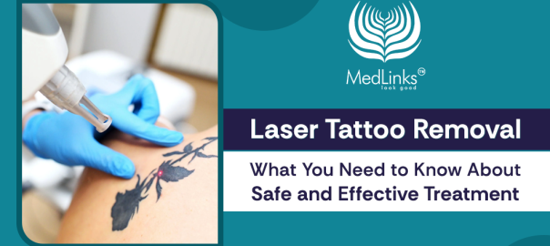 Laser Tattoo Removal in Delhi and Gurgaon, MedLinks Aesthetics