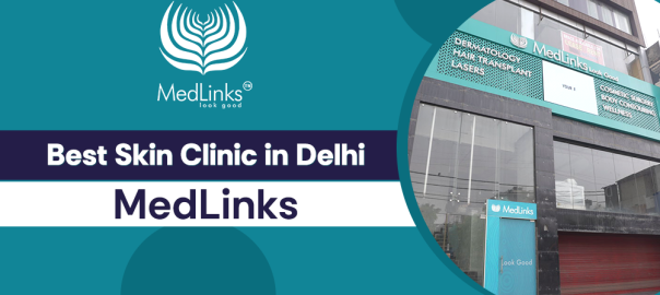 Best Skin Clinic in Delhi, MedLinks