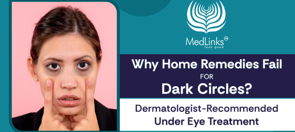 Dark Circle Treatment