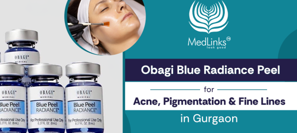 Obagi Blue Radiance Peel treatment for acne and pigmentation at MedLinks Gurgaon