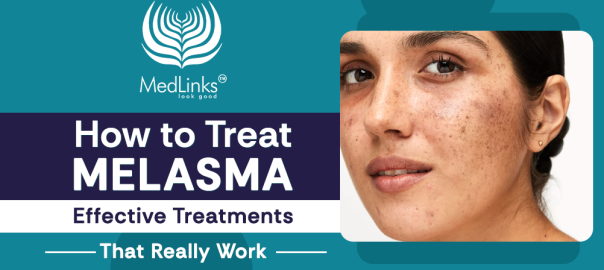 How to treat melasma with effective pigmentation treatments